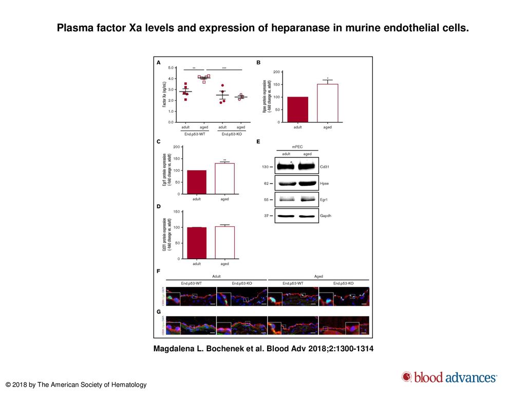 Plasma factor Xa levels and expression of heparanase in murine endothelial cells.