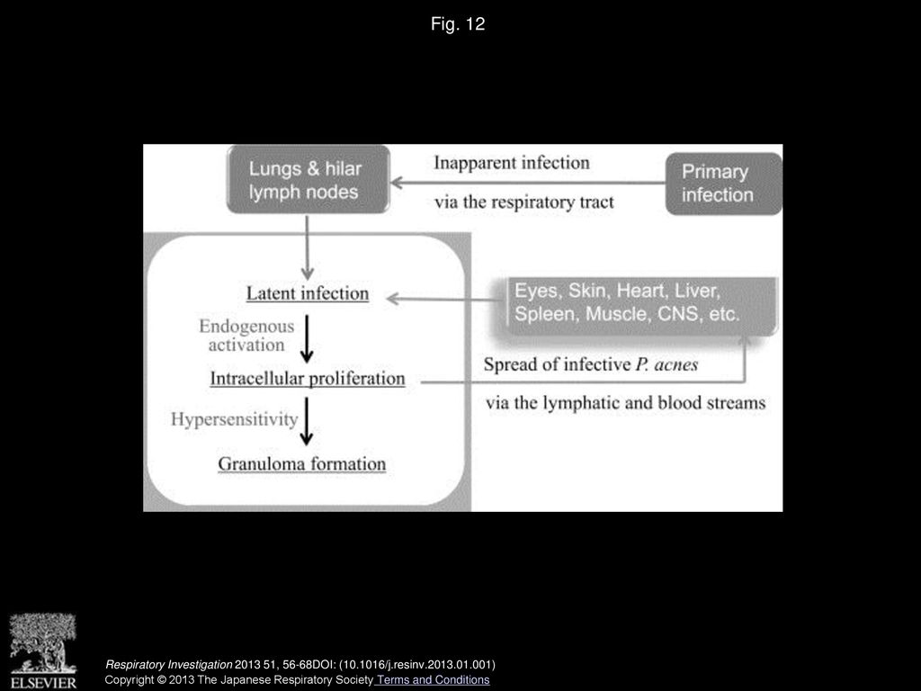 Fig. 12 Hypothesized mechanism of systemic sarcoid granuloma formation caused by P. acnes. CNS: central nervous system.