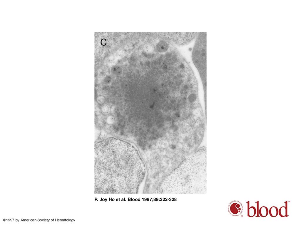 P. Joy Ho et al. Blood 1997;89: ©1997 by American Society of Hematology