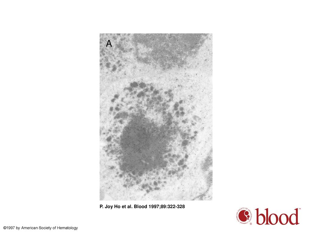 P. Joy Ho et al. Blood 1997;89: ©1997 by American Society of Hematology