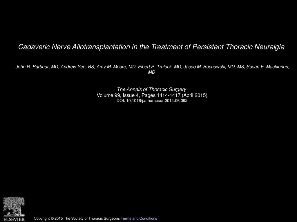 Cadaveric Nerve Allotransplantation in the Treatment of Persistent Thoracic Neuralgia