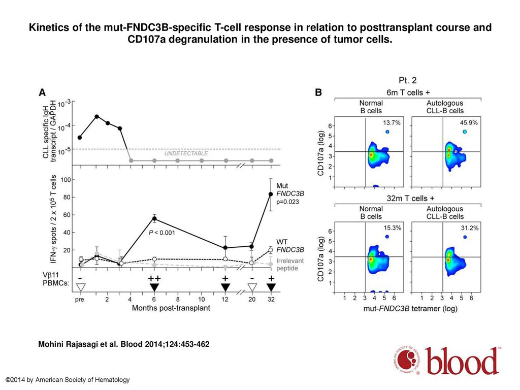 Kinetics of the mut-FNDC3B-specific T-cell response in relation to posttransplant course and CD107a degranulation in the presence of tumor cells.