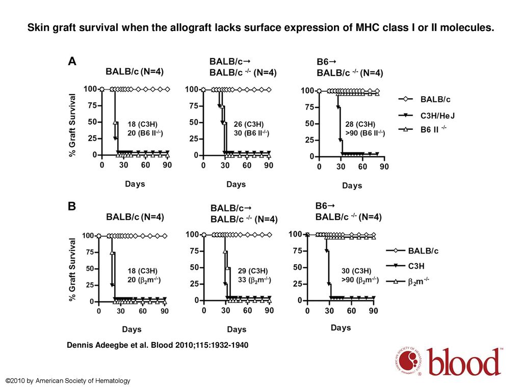 Skin graft survival when the allograft lacks surface expression of MHC class I or II molecules.