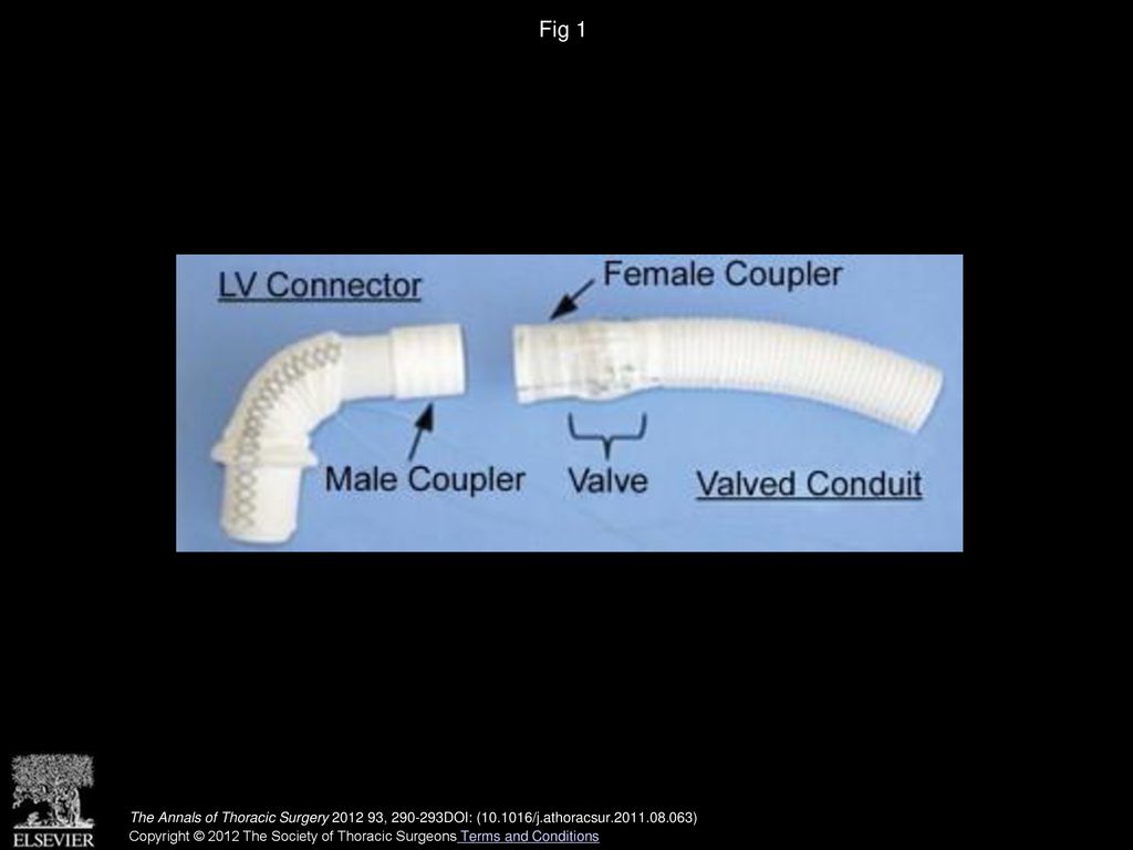 Fig 1 Correx left ventricle (LV) connector and valved conduit.