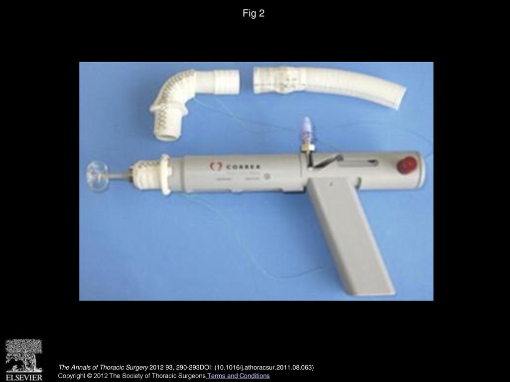 Fig 2 Implant set, and apical left ventricle connector mounted on the applicator.