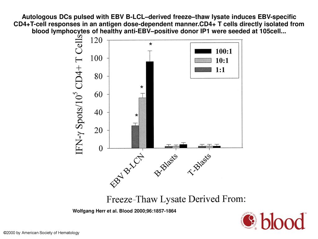 Autologous DCs pulsed with EBV B-LCL–derived freeze–thaw lysate induces EBV-specific CD4+T-cell responses in an antigen dose-dependent manner.CD4+ T cells directly isolated from blood lymphocytes of healthy anti-EBV–positive donor IP1 were seeded at 105cell...