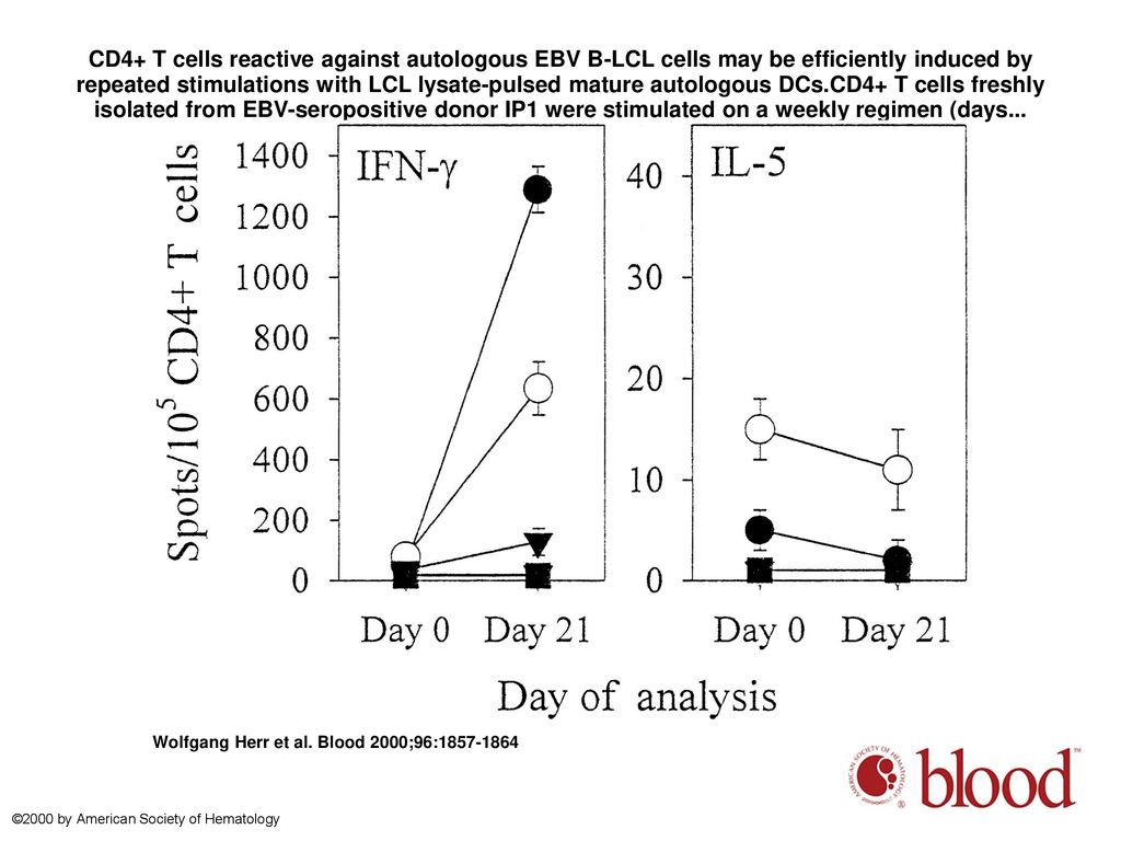 CD4+ T cells reactive against autologous EBV B-LCL cells may be efficiently induced by repeated stimulations with LCL lysate-pulsed mature autologous DCs.CD4+ T cells freshly isolated from EBV-seropositive donor IP1 were stimulated on a weekly regimen (days...