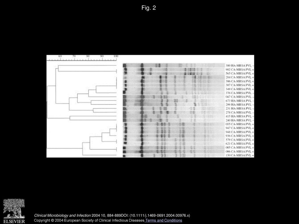 Fig. 2 Pulsed-field gel electrophoresis patterns of 24 methicillin-resistant Staphylococcus aureus isolates from cutaneous infections.