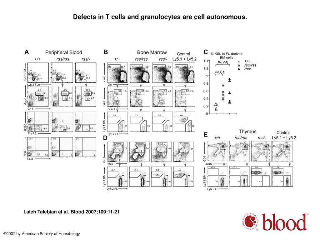 Defects in T cells and granulocytes are cell autonomous.