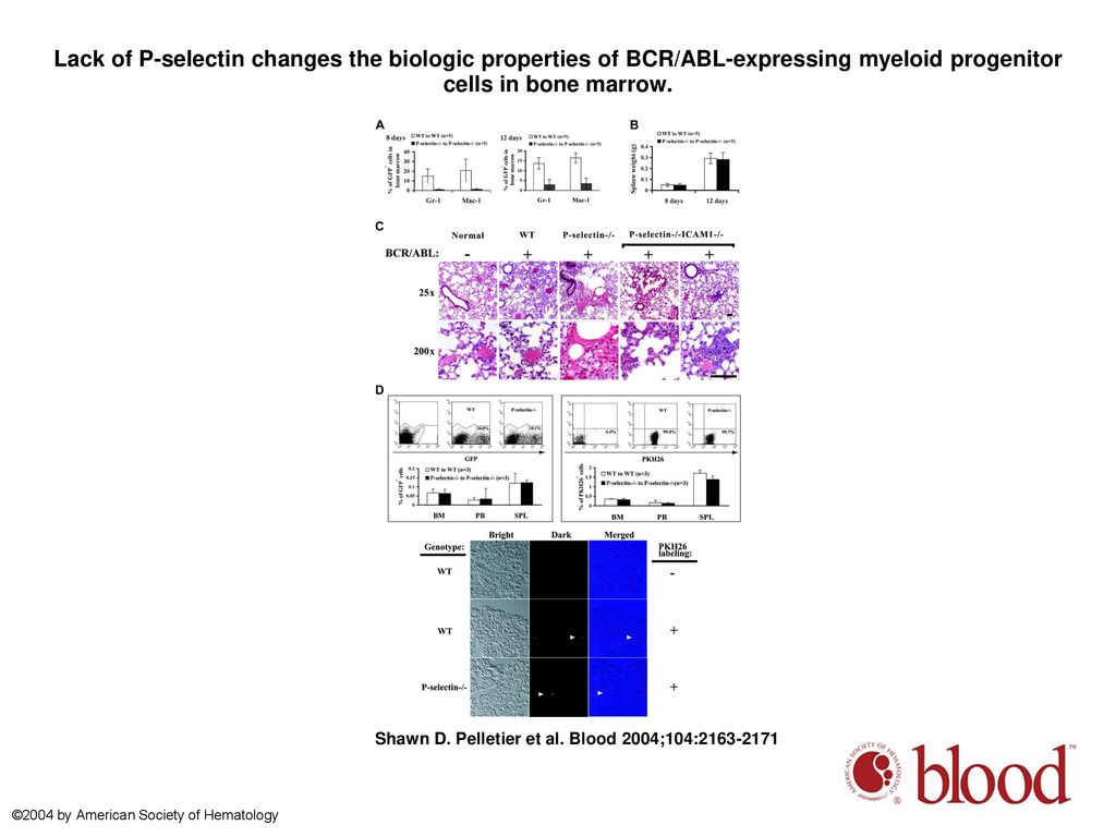 Lack of P-selectin changes the biologic properties of BCR/ABL-expressing myeloid progenitor cells in bone marrow.