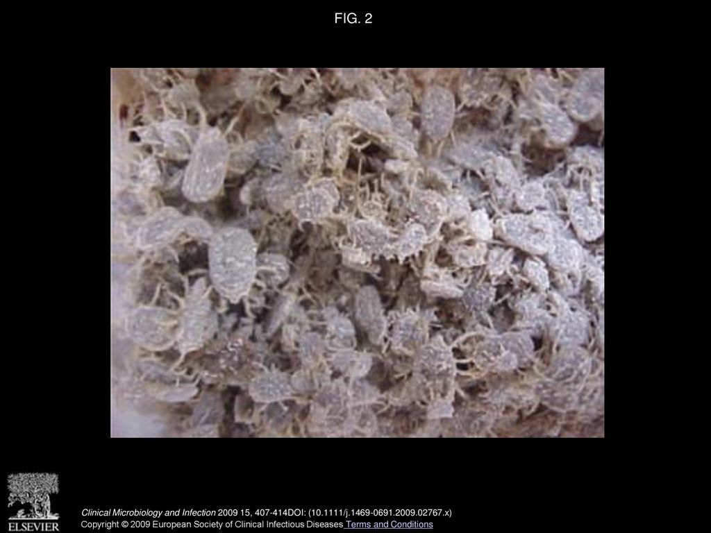 FIG. 2 Thousands of Ornithodoros ticks collected using a dry ice trap.
