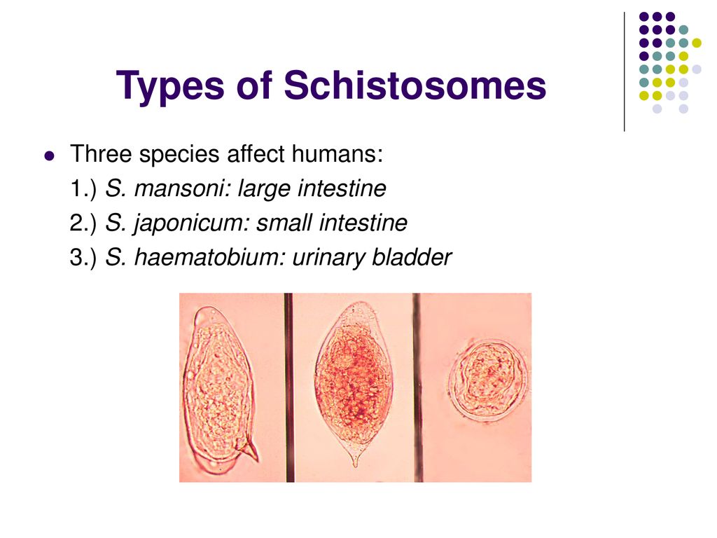 types of schistosomiasis