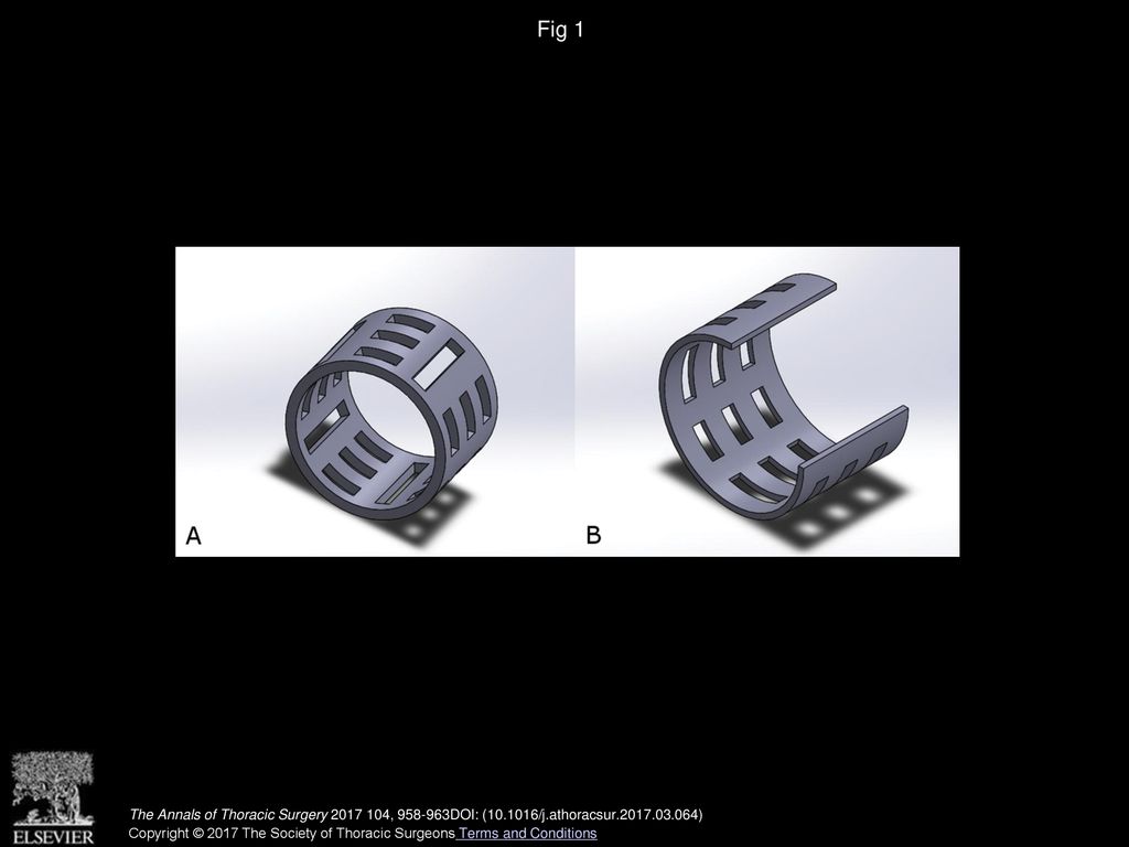 Fig 1 Virtual models of the two different polycaprolactone segment designs: (A) design I and (B) design II.