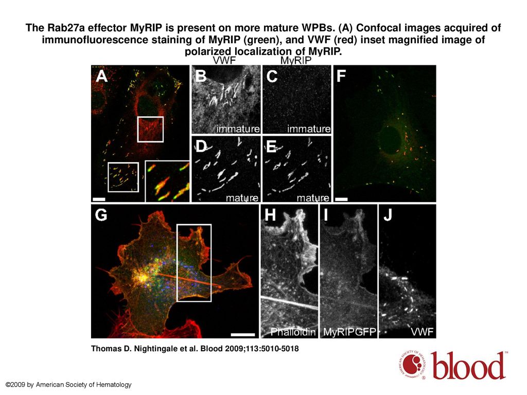 The Rab27a effector MyRIP is present on more mature WPBs