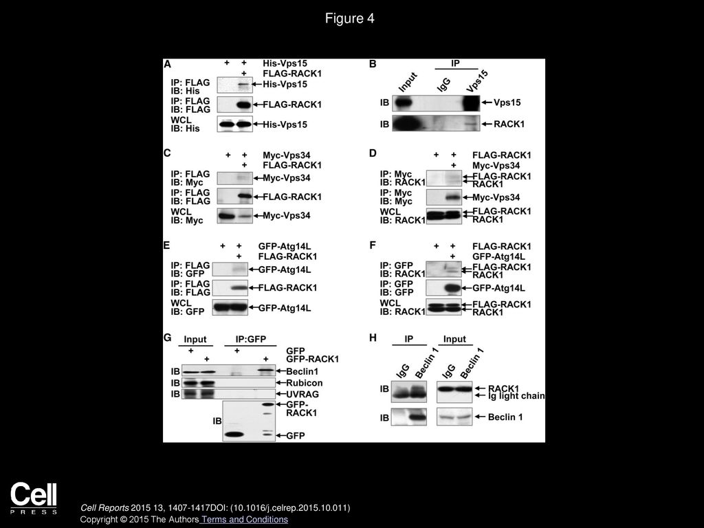 Figure 4 RACK1 Is a Component of the Atg14L-Beclin 1-Vps34-Vps15 Complex.