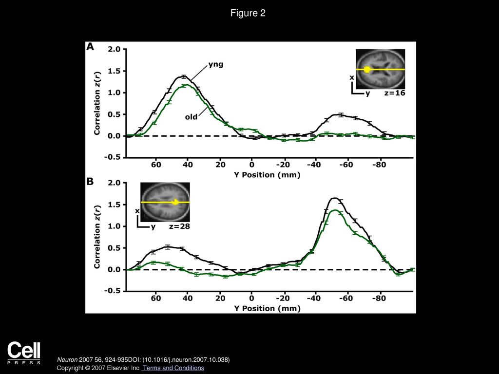 Figure 2 Reduced Functional Correlations Observed Anatomically