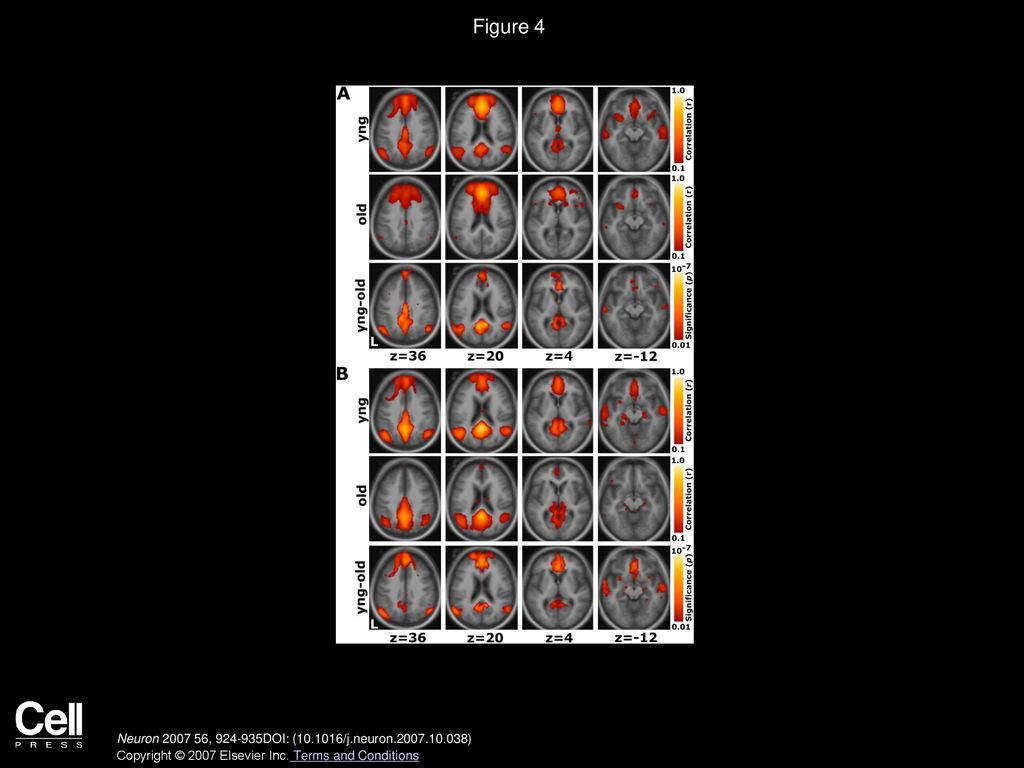 Figure 4 Whole-Brain Exploratory Analyses Reveal Widespread Correlation Reductions in Aging.