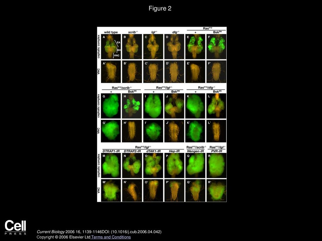 Figure 2 JNK Pathway Activation Is Essential for Both Accelerated Tumor Growth and Metastatic Behavior.