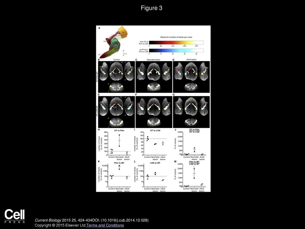 Figure 3 dMRI Reveals Increased Connectivity between Optic Tract, Visual Thalamus, and MT following a V1 Lesion in Early Life.