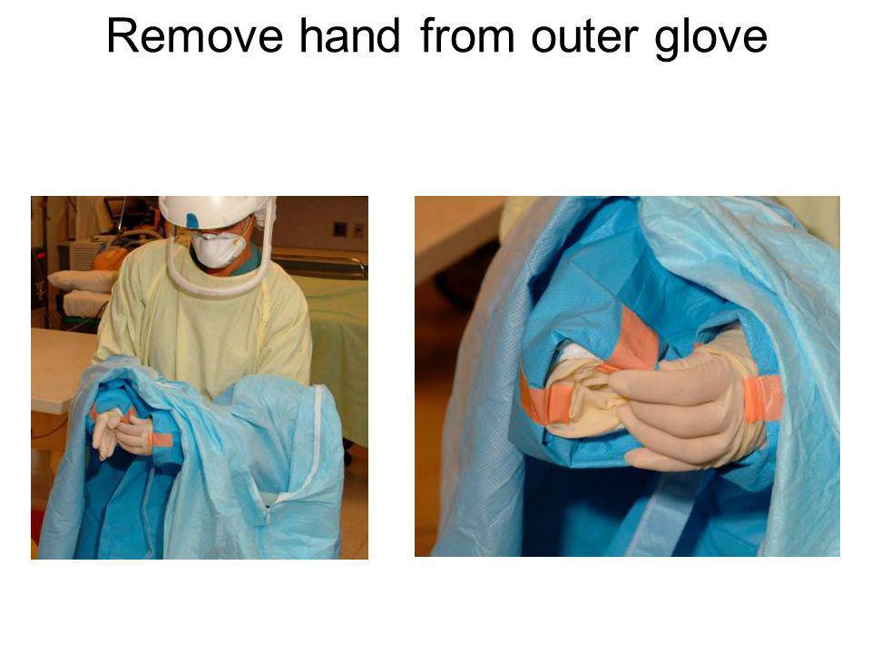 Remove hand from outer glove