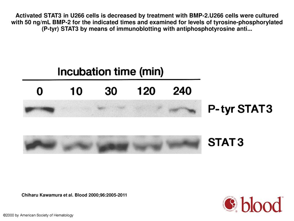Activated STAT3 in U266 cells is decreased by treatment with BMP-2