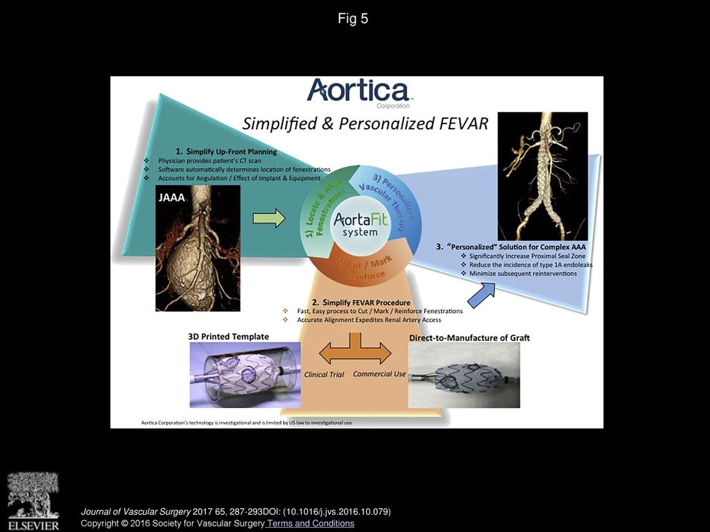 Fig 5 Outline of the Aortica concept for customized aortic endografts with automated planning.