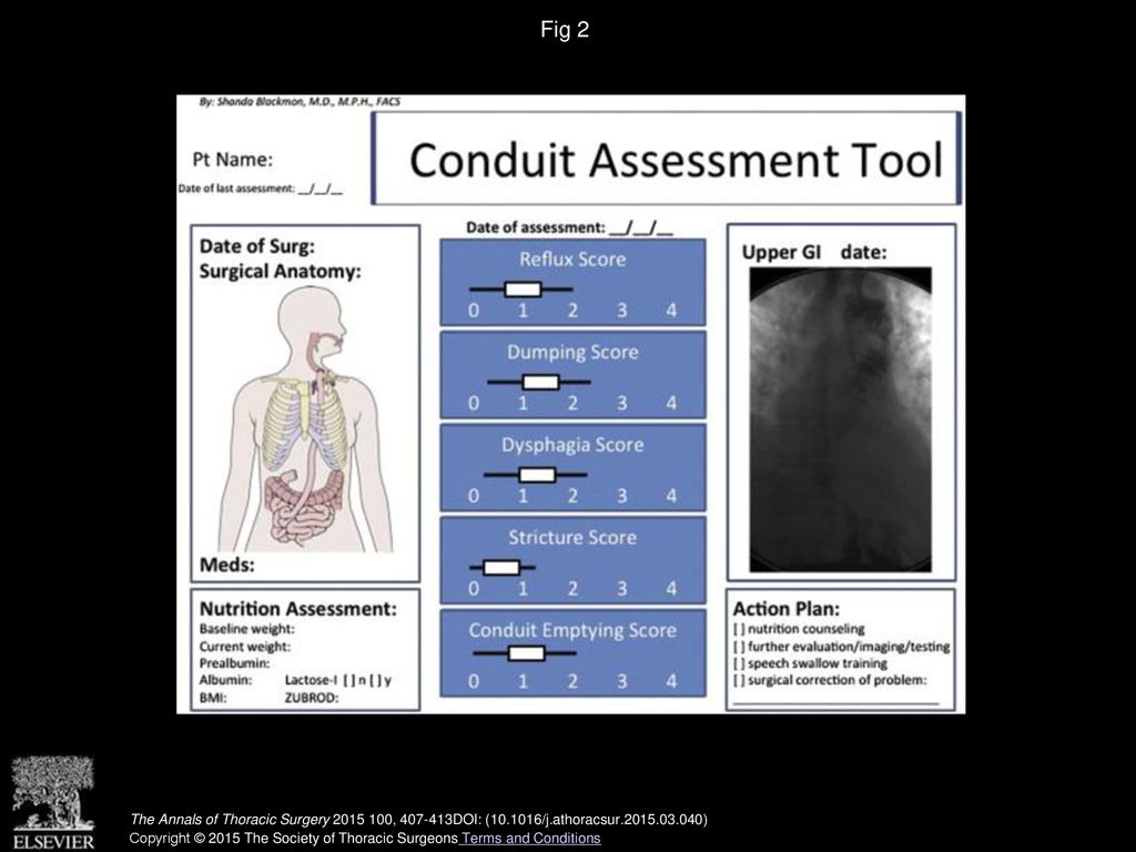 Fig 2 Super-charged pedicled jejunal conduit report card. (BMI = body mass index; GI = gastrointestinal.)