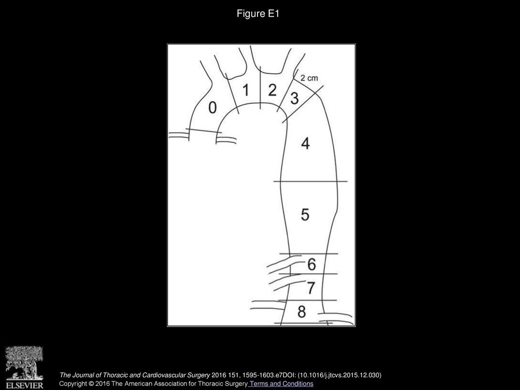 Figure E1 Landing zones described by Fillinger and the Society for Vascular Surgery.18.