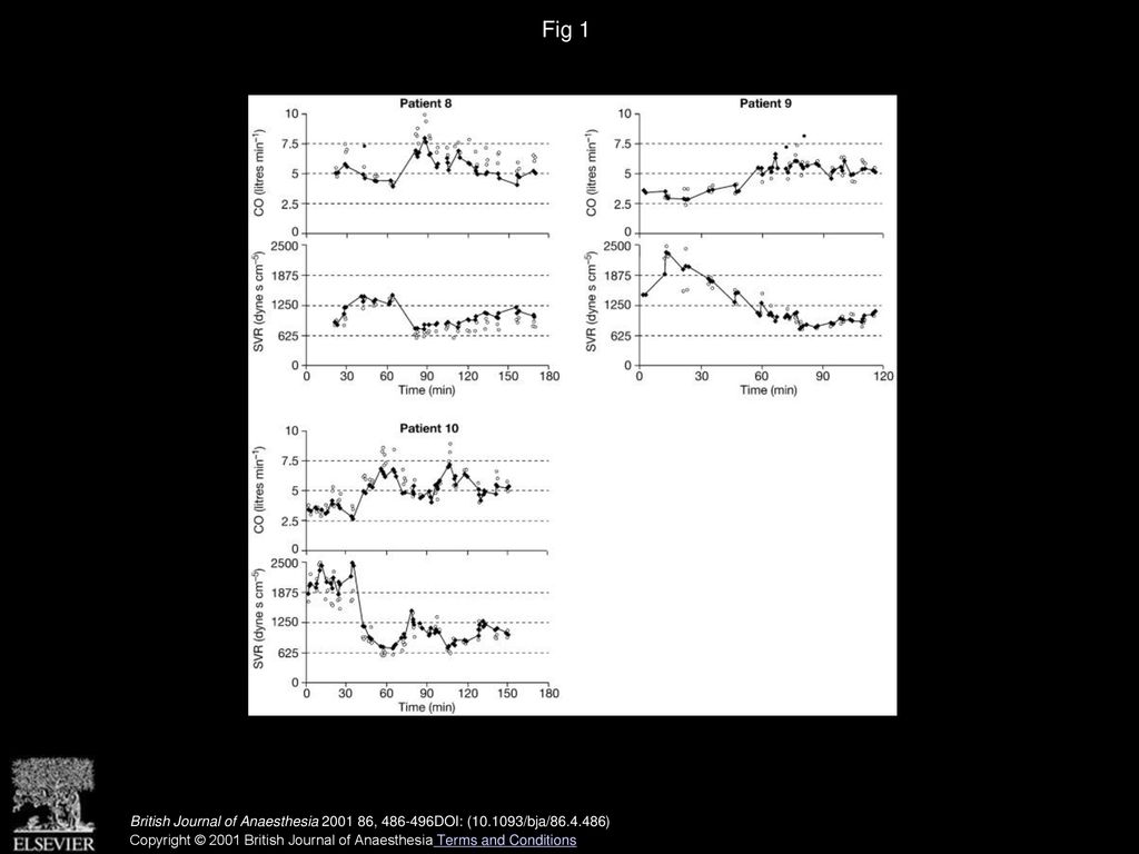 Fig 1 Trend plots for cardiac output (CO) and systemic vascular resistance (SVR) in each patient. See p. 490 for details.