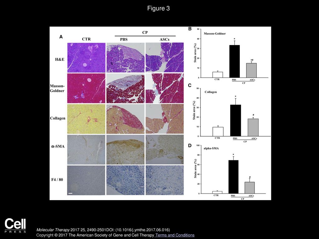 Figure 3 Effects of ASC Injection on Pancreas Damage, Fibrosis, and Macrophage Infiltration.