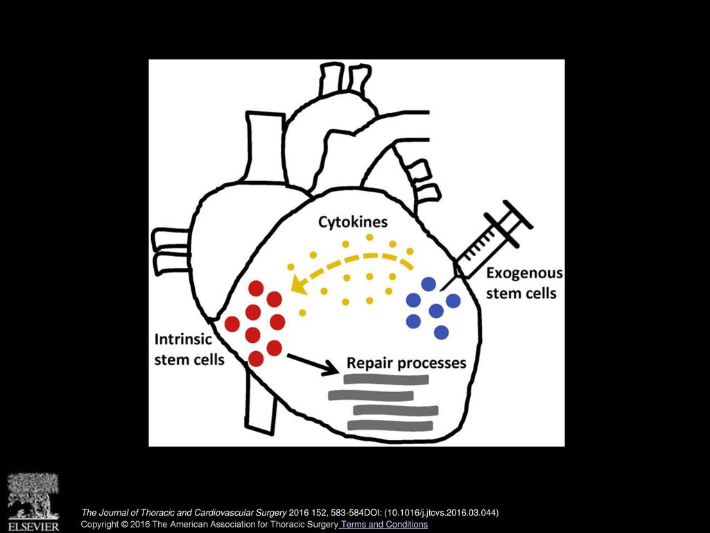 Synergistic effect of intrinsic stem cells and implanted cells on cardiac repair.