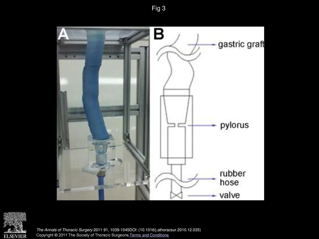 Fig 3 (A) Gastric tube model connected to the pylorus model. (B) Schematic drawing of the model.