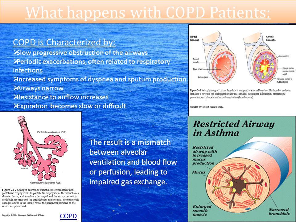 What happens with COPD Patients: