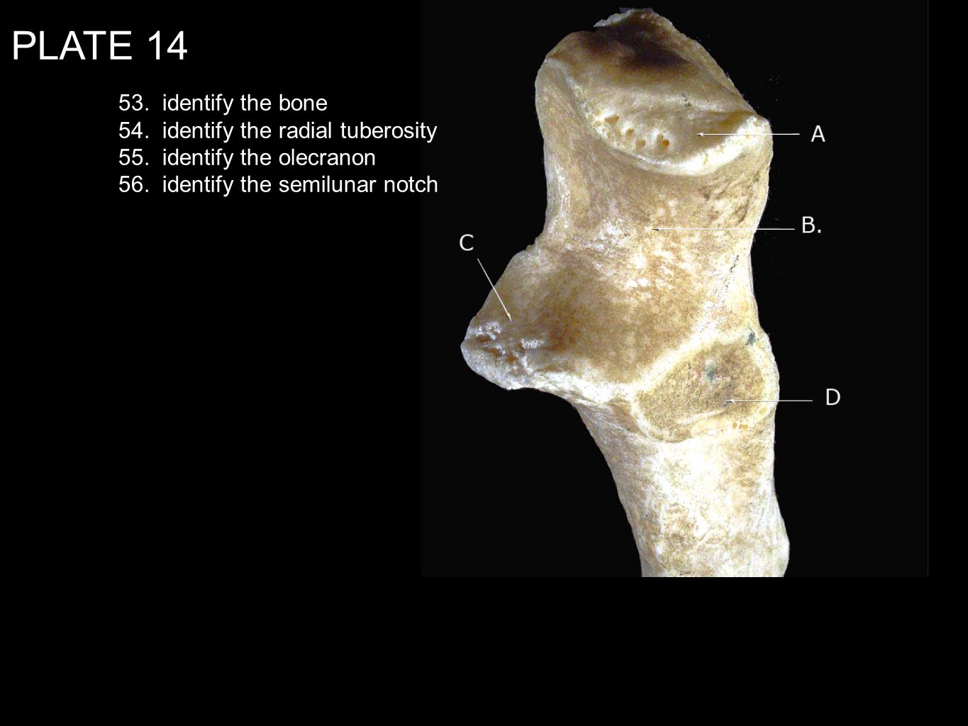 PLATE identify the bone 54. identify the radial tuberosity