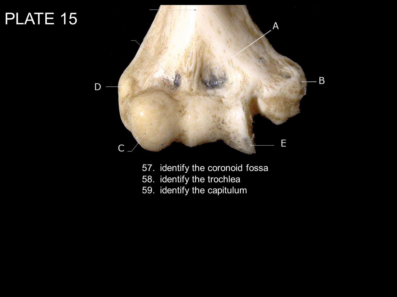 PLATE identify the coronoid fossa 58. identify the trochlea