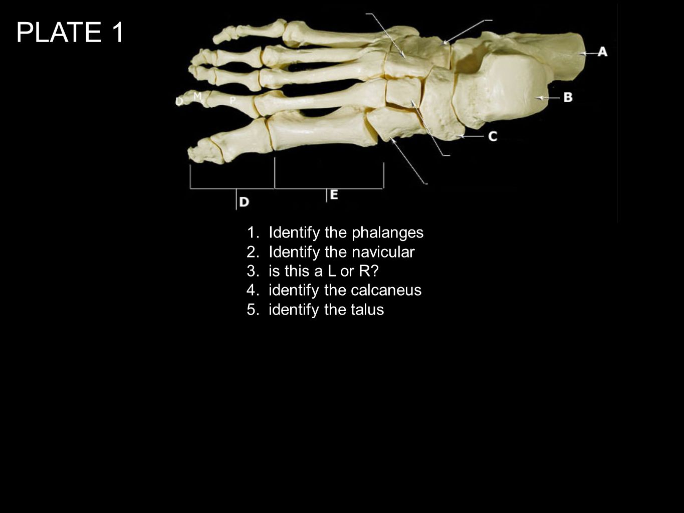 PLATE 1 1. Identify the phalanges 2. Identify the navicular