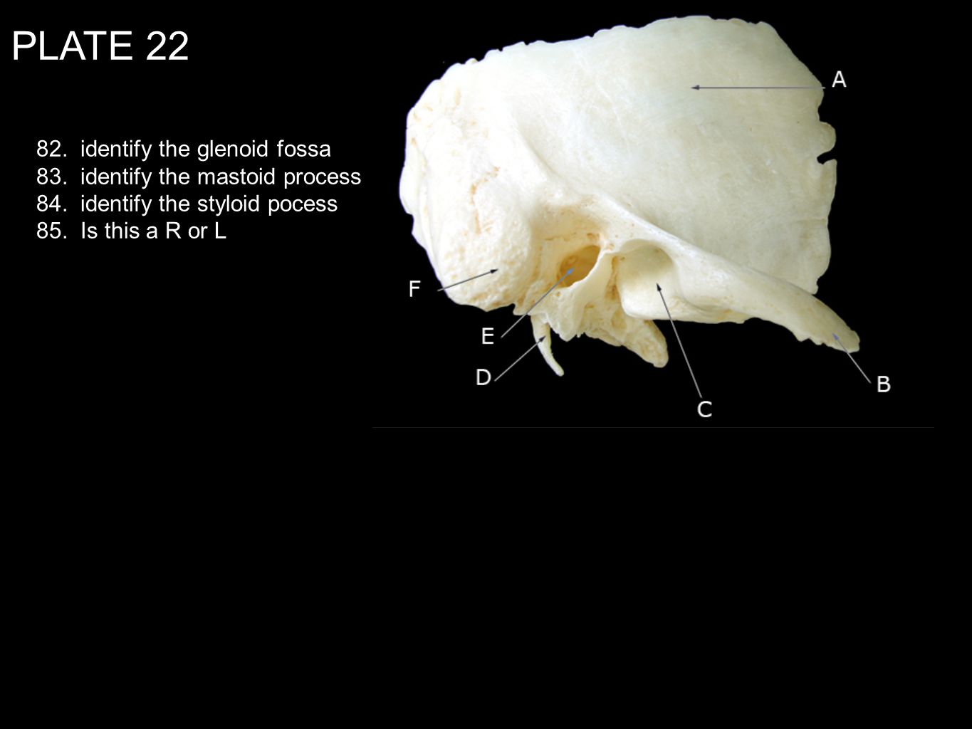 PLATE identify the glenoid fossa