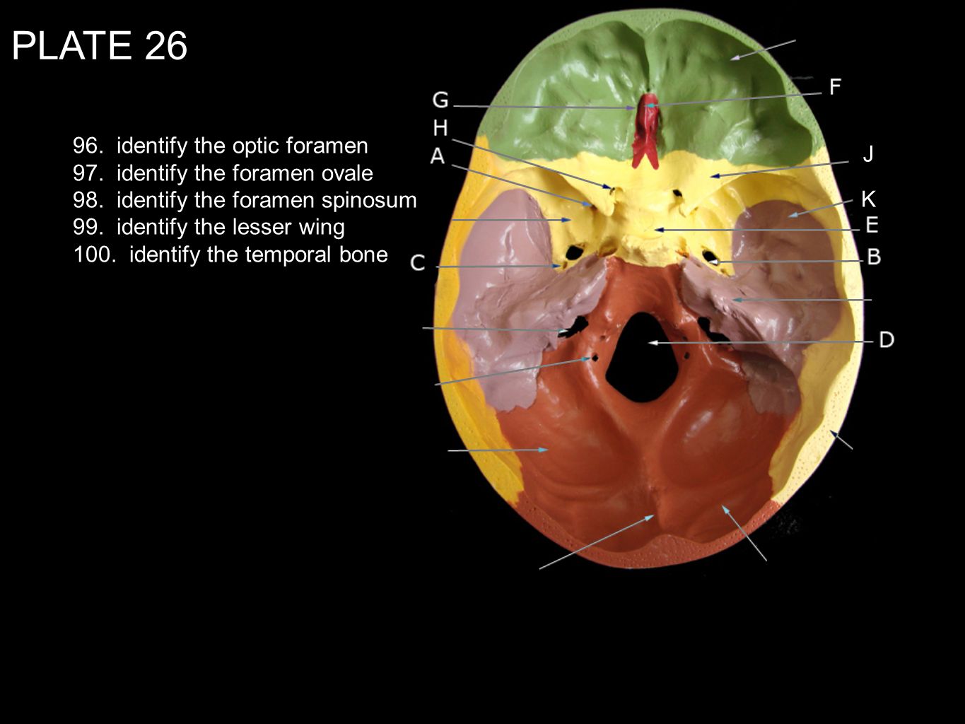 PLATE identify the optic foramen J
