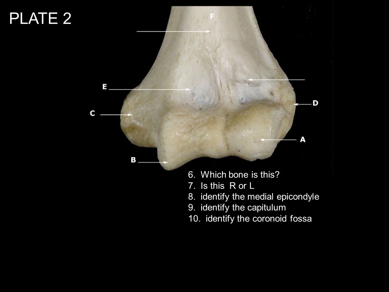PLATE 2 6. Which bone is this 7. Is this R or L