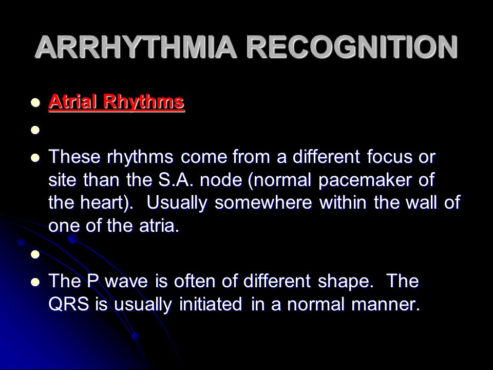 ARRHYTHMIA RECOGNITION