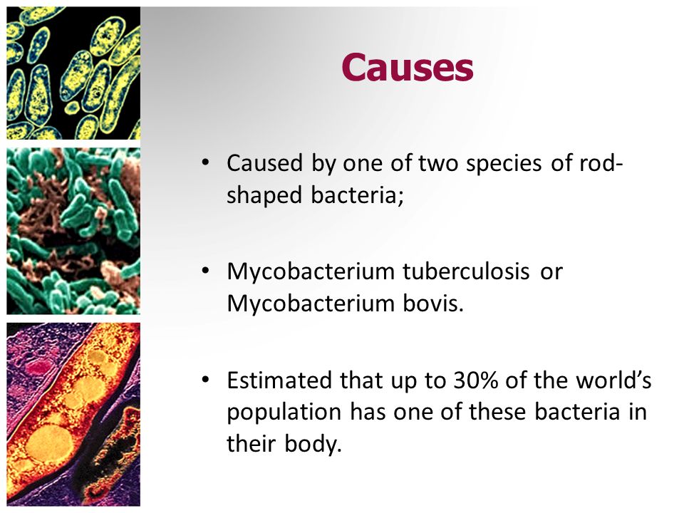 Causes Caused by one of two species of rod-shaped bacteria;