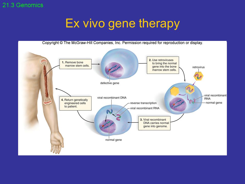 21.3 Genomics Ex vivo gene therapy