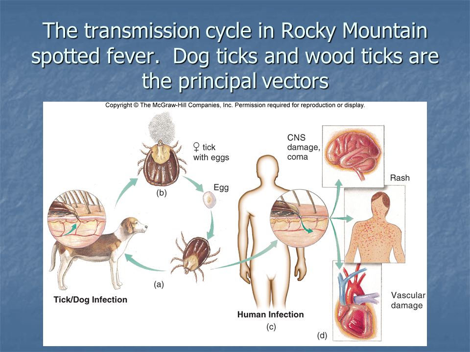The+transmission+cycle+in+Rocky+Mountain+spotted+fever.jpg