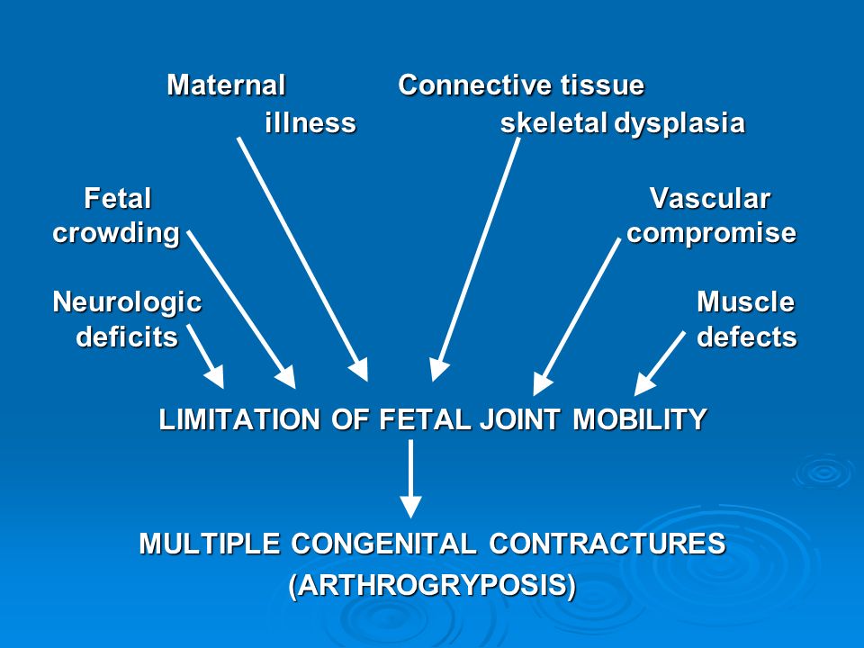 LIMITATION OF FETAL JOINT MOBILITY MULTIPLE CONGENITAL CONTRACTURES