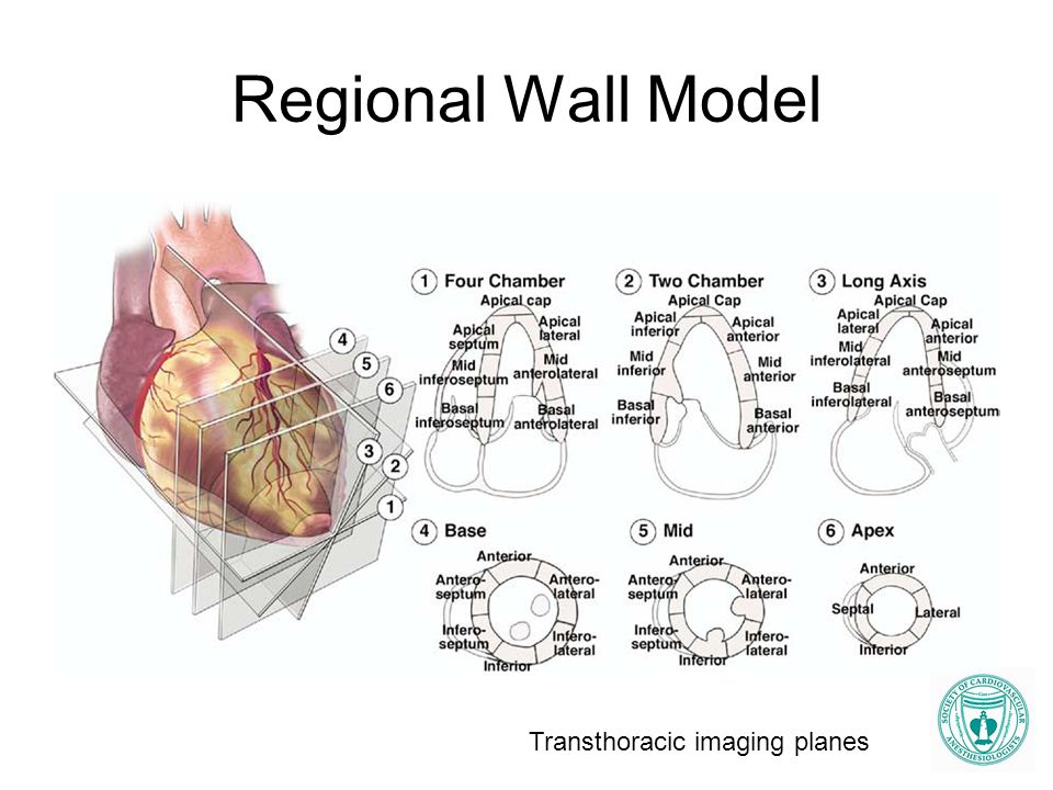 Regional Wall Model Transthoracic imaging planes