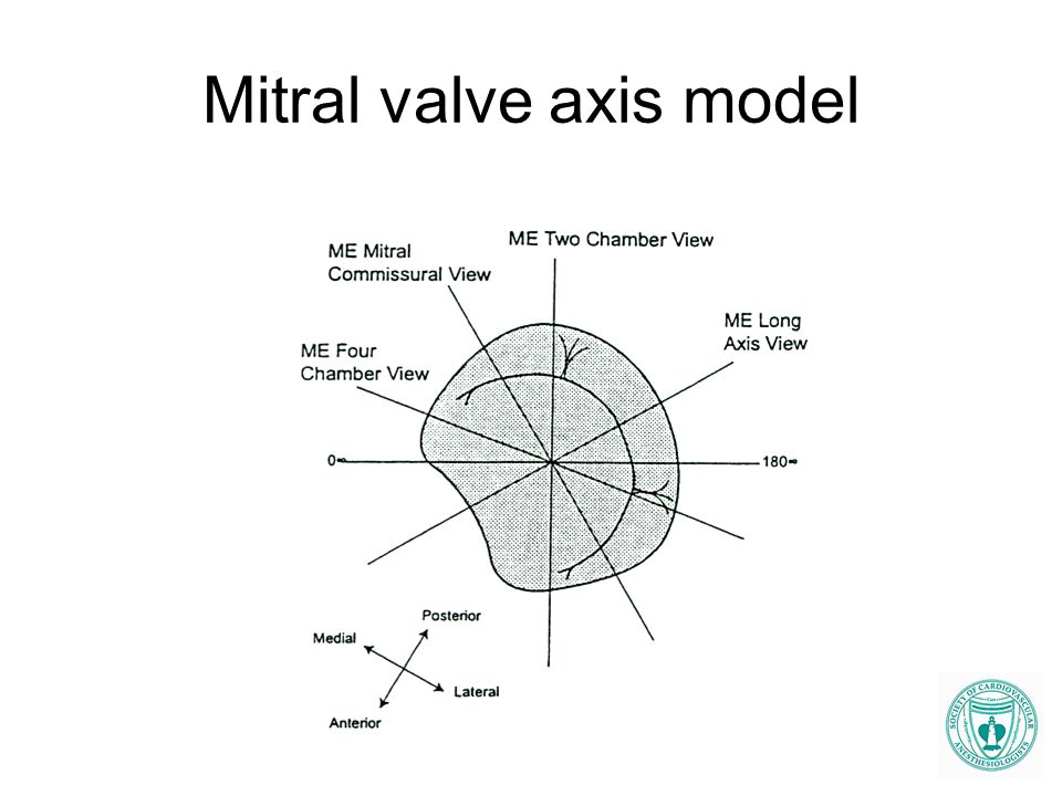 Mitral valve axis model