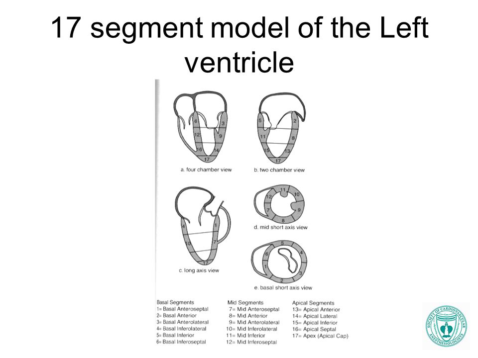 17 segment model of the Left ventricle