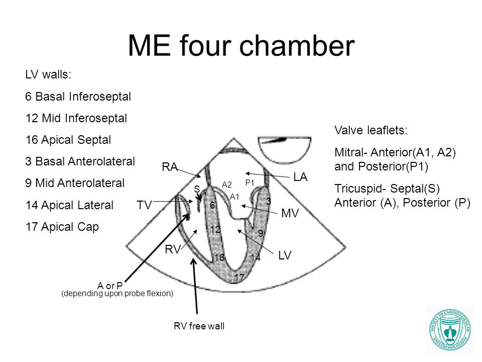 ME four chamber LV walls: 6 Basal Inferoseptal 12 Mid Inferoseptal