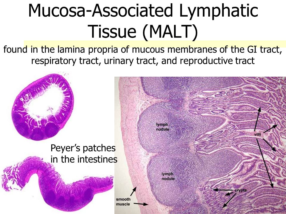 Mucosa-Associated Lymphatic Tissue (MALT)