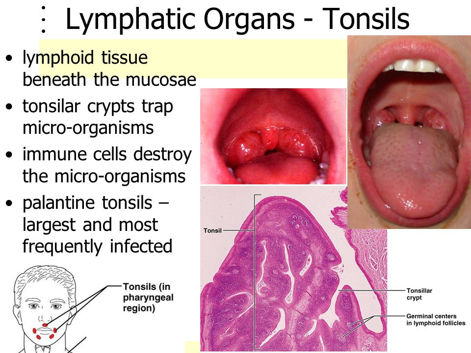 Lymphatic Organs - Tonsils